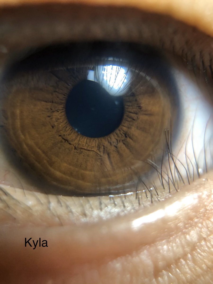 CMacBiology's tweet photo. MacroPhotography and Genetics... 😍 Today, the brown eyes have it 👏🏼👌🏼 @SalemHSVB @cindyqb @LeeaneTurnbull @jknightshs @MatthewDelaney9 https://t.co/KiQTBDGDbj