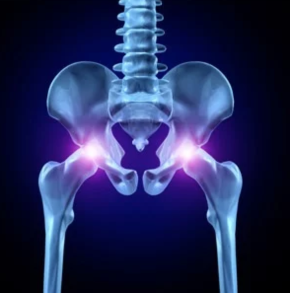 nashvilleorthos's tweet photo. Evaluating #hipproblems is more elusive than knees or shoulders. A published scientific article on this subject reported that young adults with non-arthritic hip problems... https://t.co/r9lTPK58rL