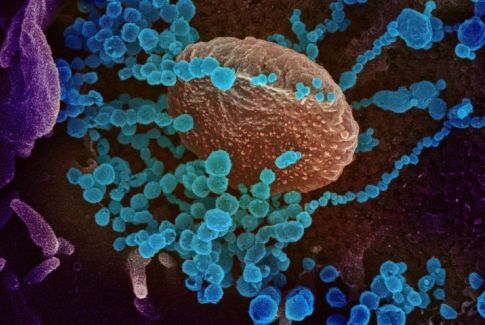 MendelsonAcad's tweet photo. Working from Home: New Remote Access Capability to Address Coronavirus Concerns - #ProAdvisor #Intuit #Quickbooks https://t.co/Zsfstlxbed