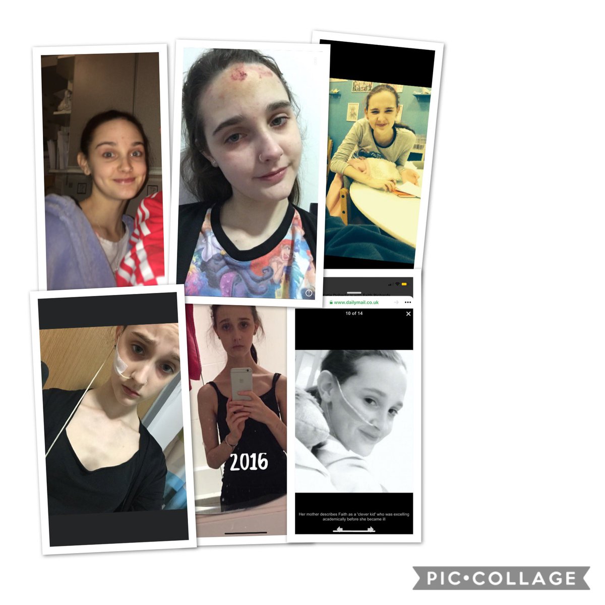FaithKelly2000's tweet photo. In honour of eating disorder awareness week. I am not posting these photos to show u all how poorly I was, I am posting them to show recovery is possible. You can hit rock bottom and you don’t have to stay there you can grow into a happier healthier person. https://t.co/D1KxAq189N
