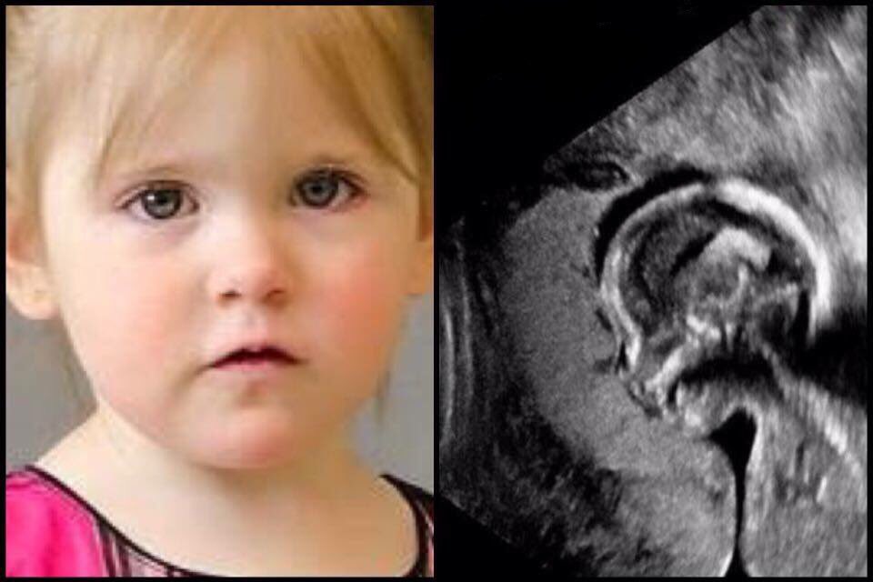 altcarter's tweet photo. A grieving mother’s broken heart is healed by miraculous signs from her daughter in heaven. She is astonished when her daughter’s face clearly appears in an ultrasound photo — proving that life is eternal.  #PitMad #A #NF #INSP #Mem #OWN https://t.co/wLTBDJrmeq