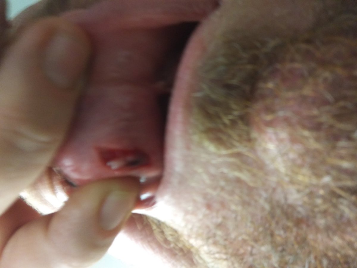 It been a long week, Tuesday I tried to steal a kiss from Kana and she made me pay for it.