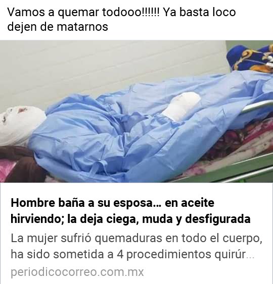 Gonzaalez_aime's tweet photo. Miedo https://t.co/RmJ9lR0Cqw