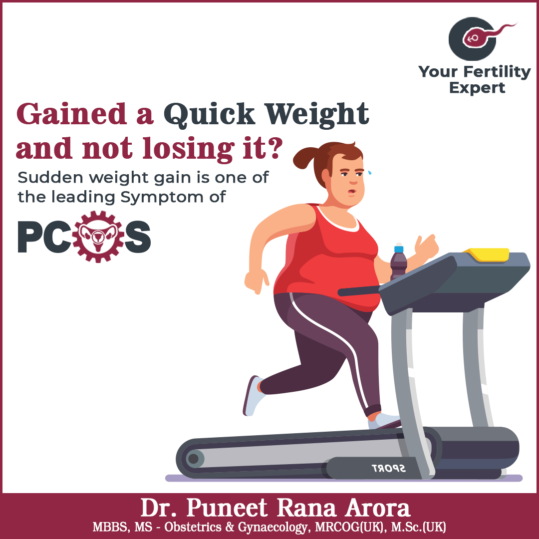 PuneetAroraIVF's tweet image. PCOS It occurs when your hormones are out of balance. The main focus is always on weight loss, diet modification and lifestyle changes for the right fertility. 
#PCOS #ExtraWeight #SaveFertility #TreatPCOS #Fertility #Infertility #YourFertilityExpert 
Call/WhatsApp: 8826539305