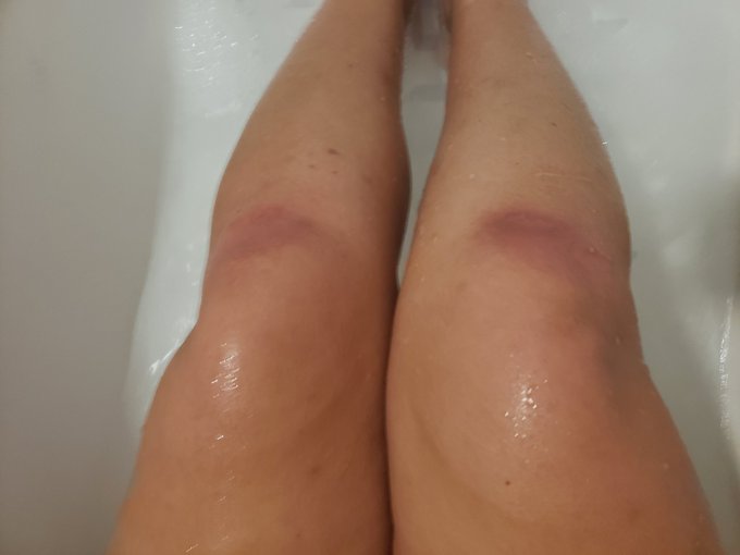 When you dominated on the rug and have the burns and bruises to show for it! 😉 &hearts; https://t.co/XFyg0V