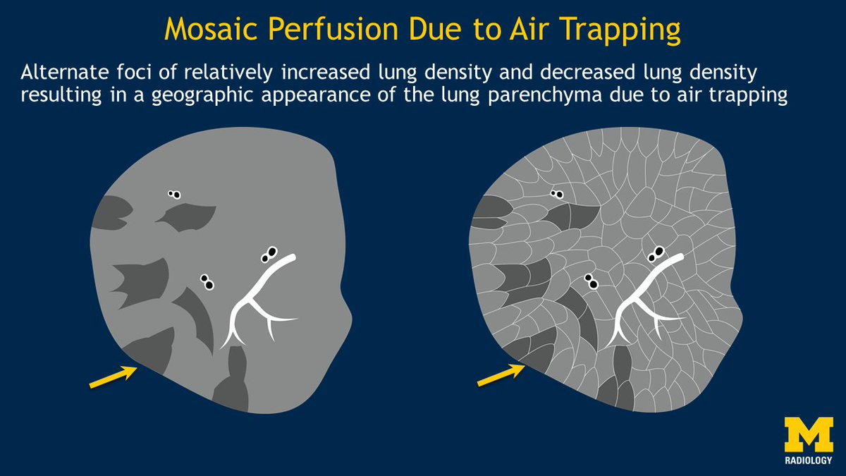 UMichRadiology's tweet photo. Introduction to HRCT by @drvummidi at

@UMichRadiology Radiology at the Seashore CME Course. #UMCaptiva2020 https://t.co/Tf3NJsef15…

Patterns of disease, differential diagnosis; vaping injuries, COVID-19. https://t.co/4ENYAKTkbe