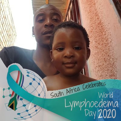 Gemini_Papi_'s tweet photo. Hey y'all,
Kindly join me and many others around the world in creating awareness about Lymphedema today. Also please use the link below to donate towards @mphomokola 's treatment. Thank you.
https://t.co/Nt1Ae5SkeE
#HelpPapaRethabile
#WorldLymphedemaDay https://t.co/9oj5WDAlNL