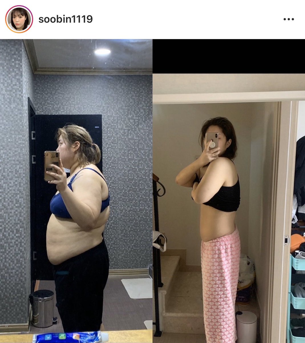 อมก. ซูบิน  ลดเยอะและเร็วมากกกกกกกกกกก ผอมลงแล้วเหมือนคนละคนเลย