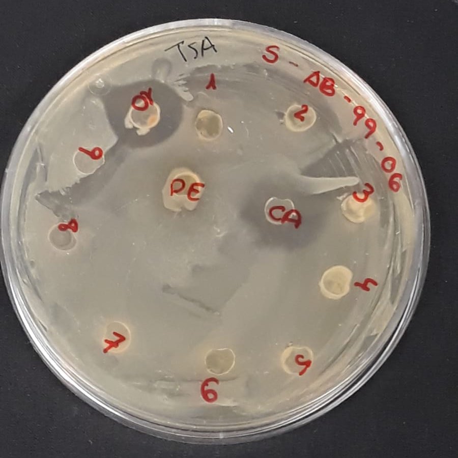 AlbaceteSwi's tweet photo. El objetivo final de esto es realizar el test con las ESKAPE-like utilizando discos de agar recortados en esas intersecciones y ponerlos en una placa frente cada una de las bacterias ESKAPE-like https://t.co/h79ncUhyM7