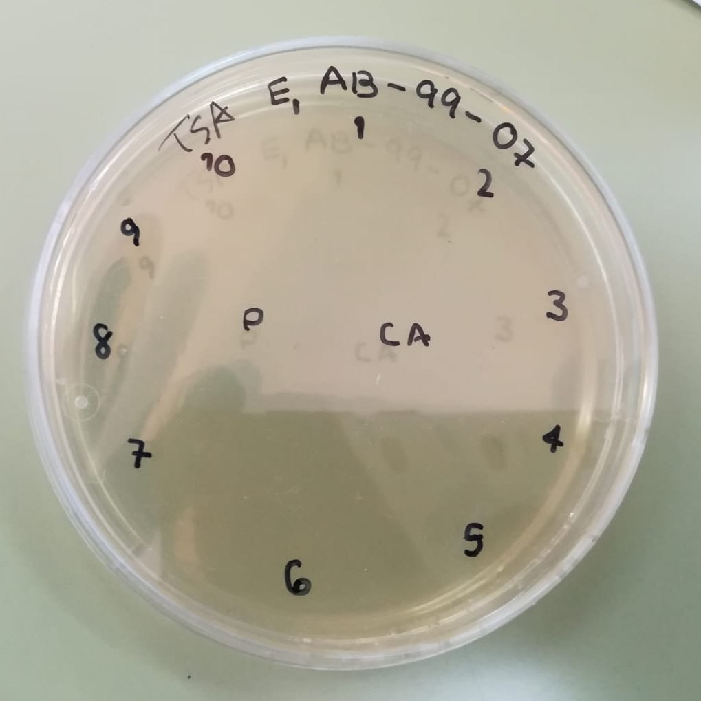 AlbaceteSwi's tweet photo. El objetivo final de esto es realizar el test con las ESKAPE-like utilizando discos de agar recortados en esas intersecciones y ponerlos en una placa frente cada una de las bacterias ESKAPE-like https://t.co/h79ncUhyM7