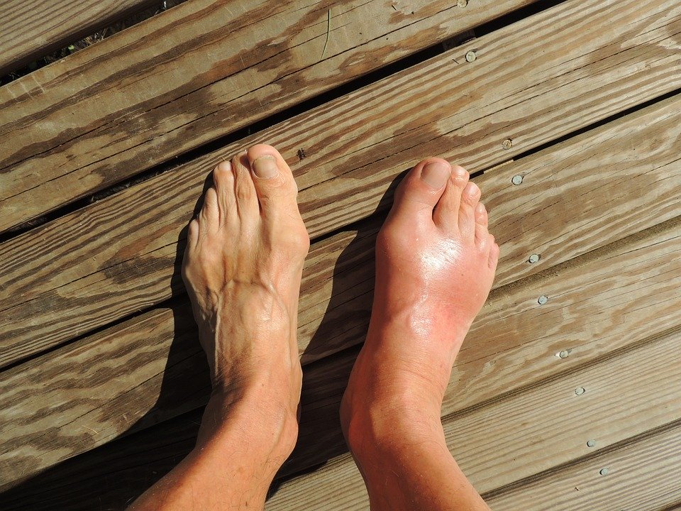 NerveRelief's tweet photo. Are you suffering from nerve pain in the feet, or hands? Take a look at a way to reduce it. #nervepain https://t.co/dc3V9GIyN3 https://t.co/jCXwIz32S3