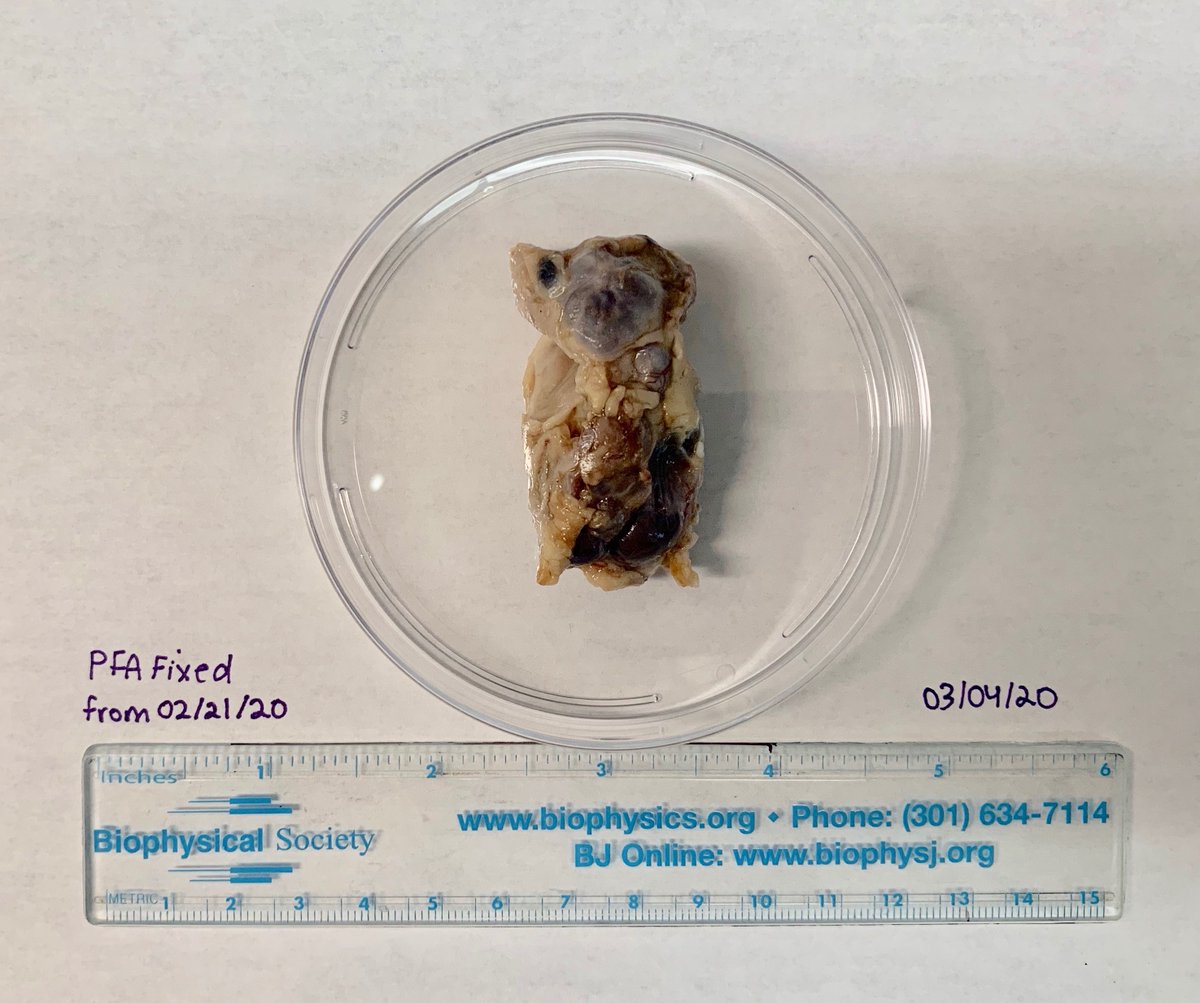 woodward_lab's tweet photo. After reviewing Zhao et al (2020) in lab meeting, we decided to explore the SHANEL protocol on PKD kidney tissue for fun. Just finished fixation and now on to the detergent step. Follow our journey to clearance! #organclearing #labupdates #kidney #PKD #papertopractice https://t.co/Pk2VOlZzEV