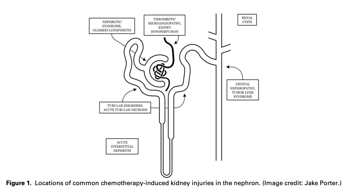ISMMSKidney's tweet photo. Review: #Nephrotoxic #Chemotherapy Agents: Old and New
https://t.co/tMZa6NU57l
@AnthonyNicolay1 @nkf @MSBI_IM
#Onconephrology https://t.co/jHQK4OjvNY