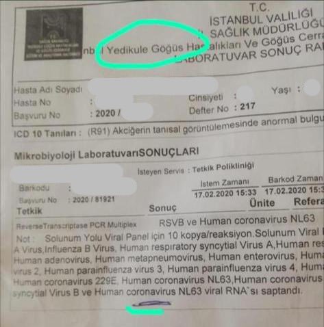 Yedikule Hastanesi’nde konulan tanı Yeni Koronavirüs (COVID-19) değil, Human Koronavirüs NL63 tanısıdır. Virüs ailesinin çok eskiden beri iyi bilinen bir tipidir. Yol açtığı rahatsızlık basit soğuk algınlığıdır. Hastamıza acil şifalar diliyoruz. Mücadelemiz, virüsün yeni tipiyle.