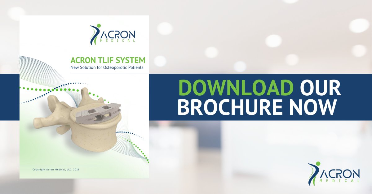 Want more information on the Acron TLIF System? Our brochure is just one click away. Download it now at Acron-medical.com. #TLIF #spineimplants