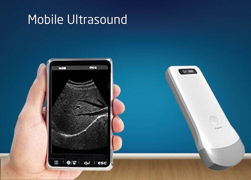 Home Care Ultrasound