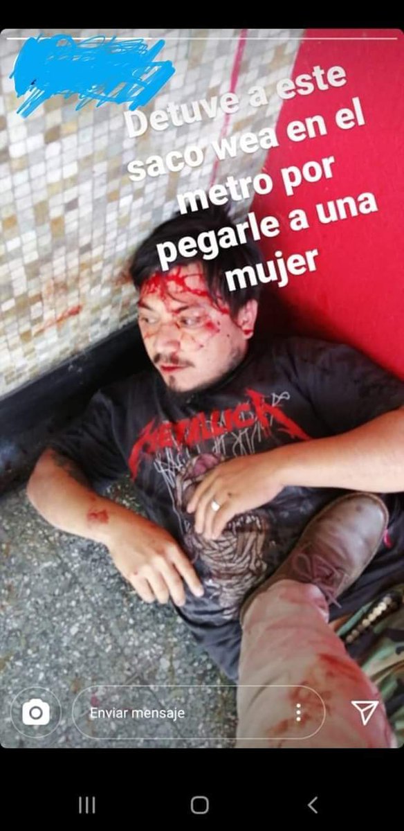 ElpocoserioPoco's tweet photo. Así quedo el choro del metro !!! 😂😂😂😂😂 https://t.co/h3AhrDToJP