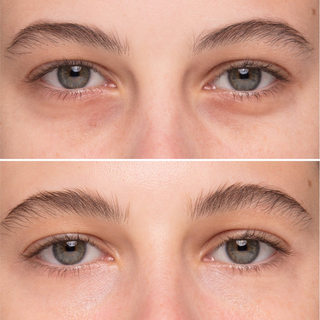 MIE Skincare tweet media