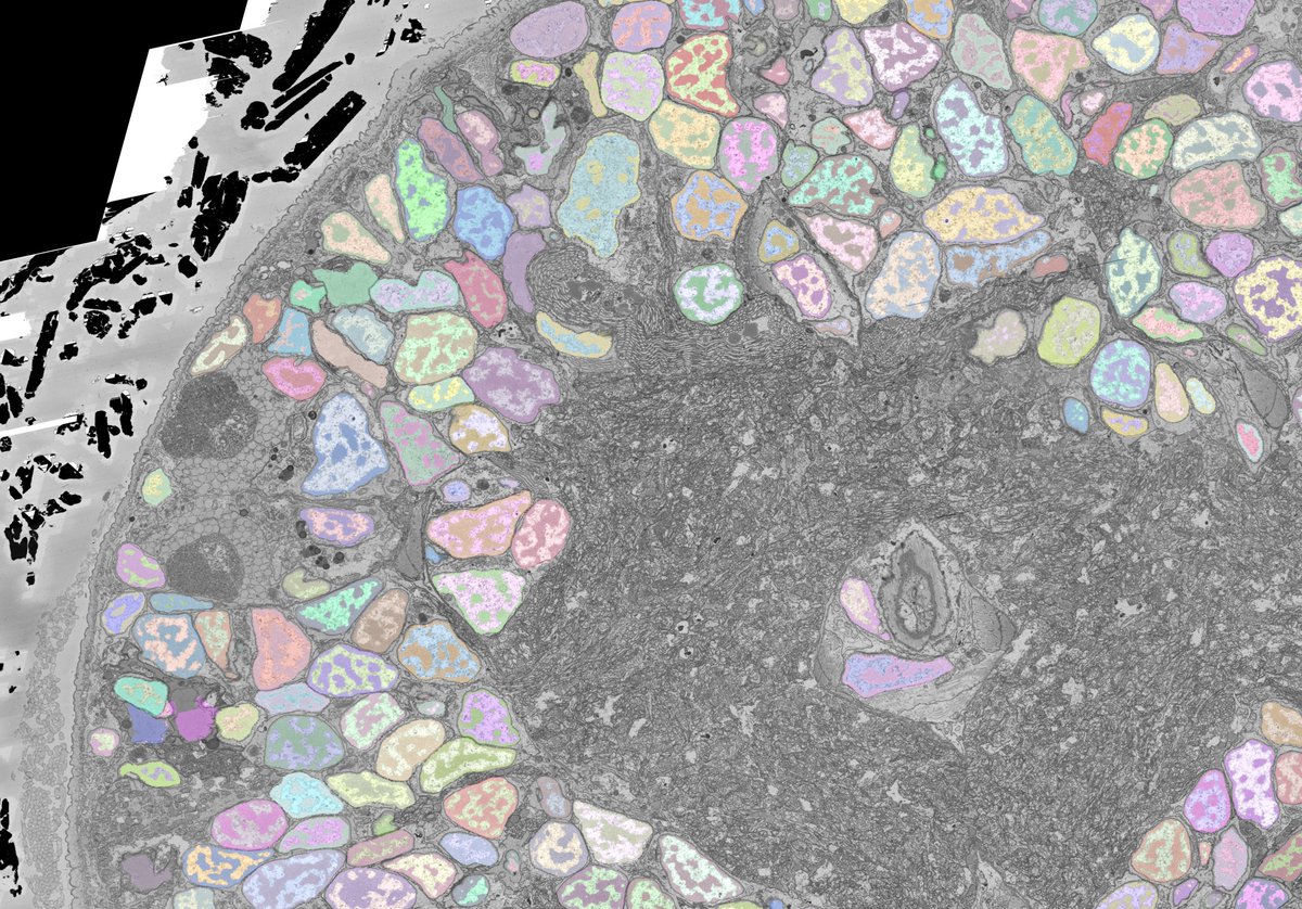 I just made an awesome screenshot using PlatyBrowser. See #Platynereis eyes, neurons, muscles, and inner and outer cilia. Colourful segmentation on top :)
Make your own here:  github.com/platybrowser/p…