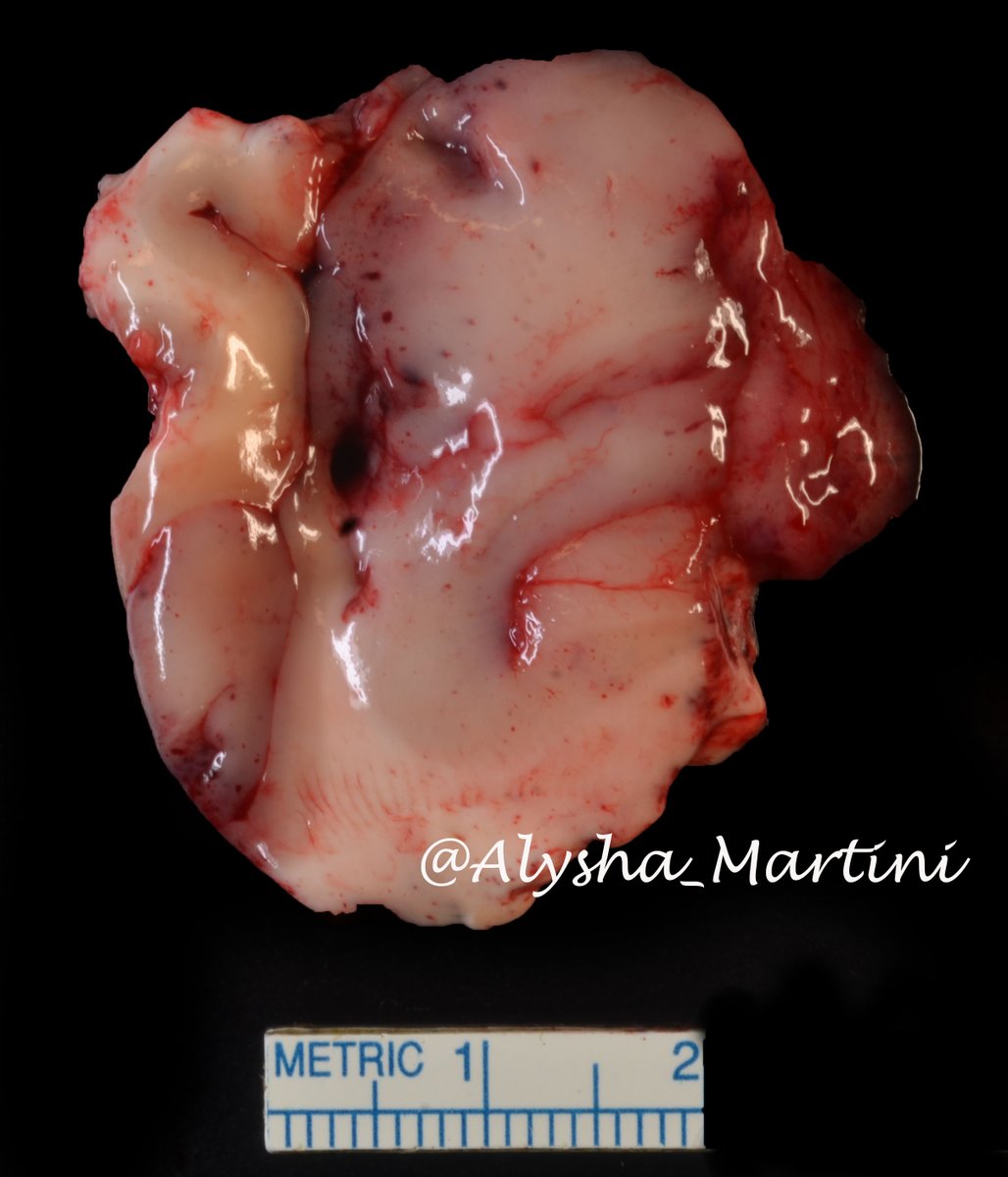 Alysha Rushton, PA (ASCP), D-ABMDI tweet media