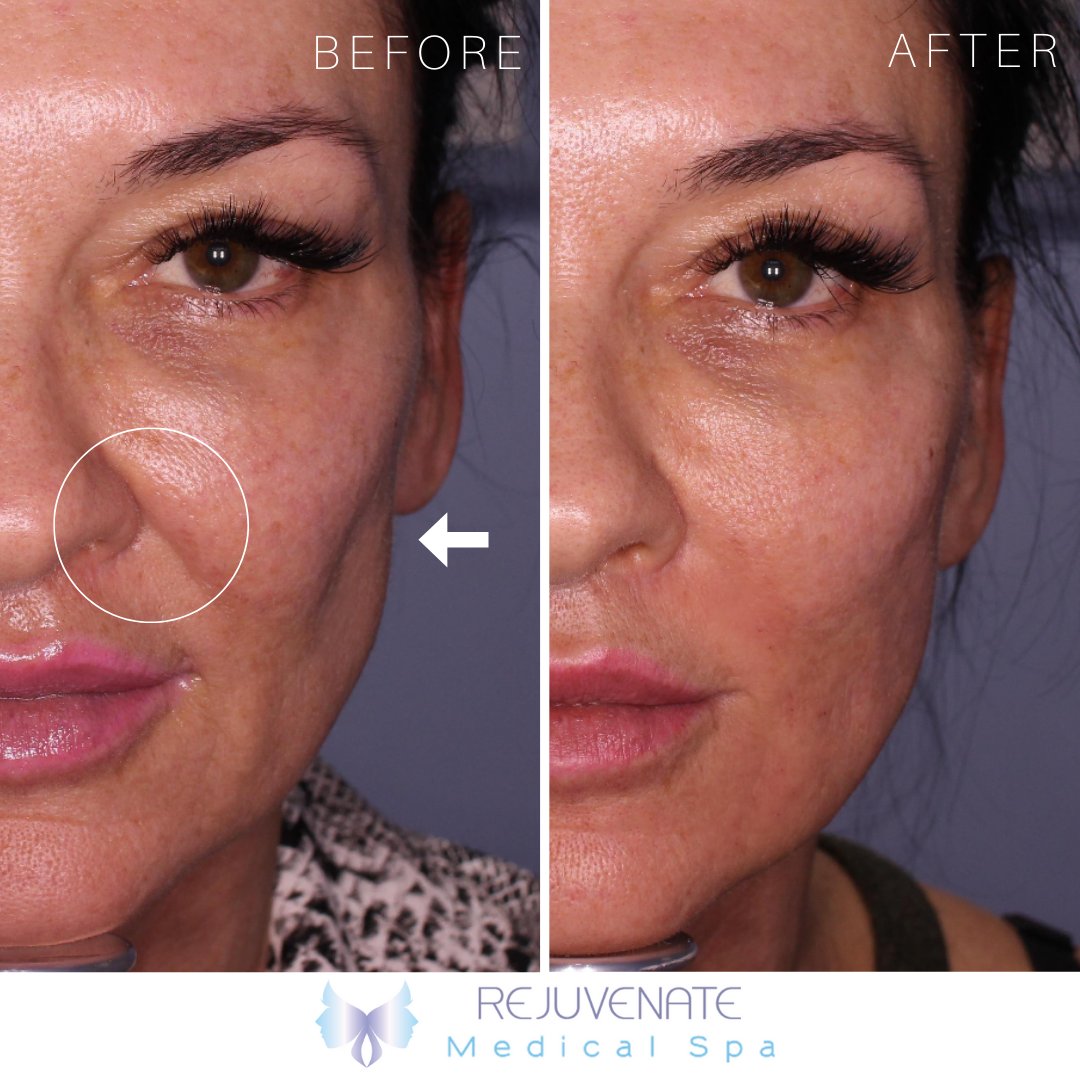 Rejuvenate Medical tweet media