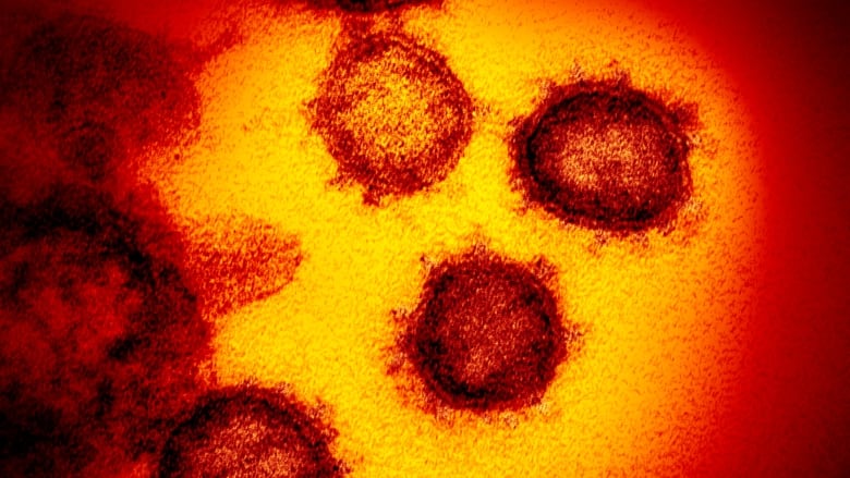 norachabib's tweet photo. La C.-B. annonce un plan d'urgence pour répondre à une éventuelle épidémie de #COVIDー19 de 3 mois. Jusque là, 2000 personnes ont été testées, soit plus que dans tous les É. -U., se félicitent les autorités de santé. 4 des 21 cas diagnostiqués en C.-B. sont guéris. #icicb https://t.co/KpEb2q5UNZ