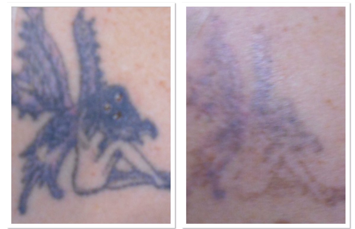 Dingwall Laser Clinic tweet media