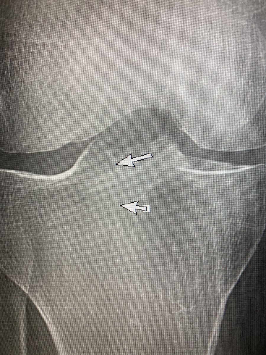 American Society of Emergency Radiology | ASER tweet media