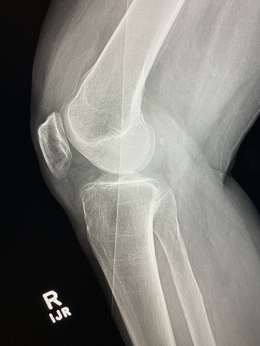 American Society of Emergency Radiology | ASER tweet media