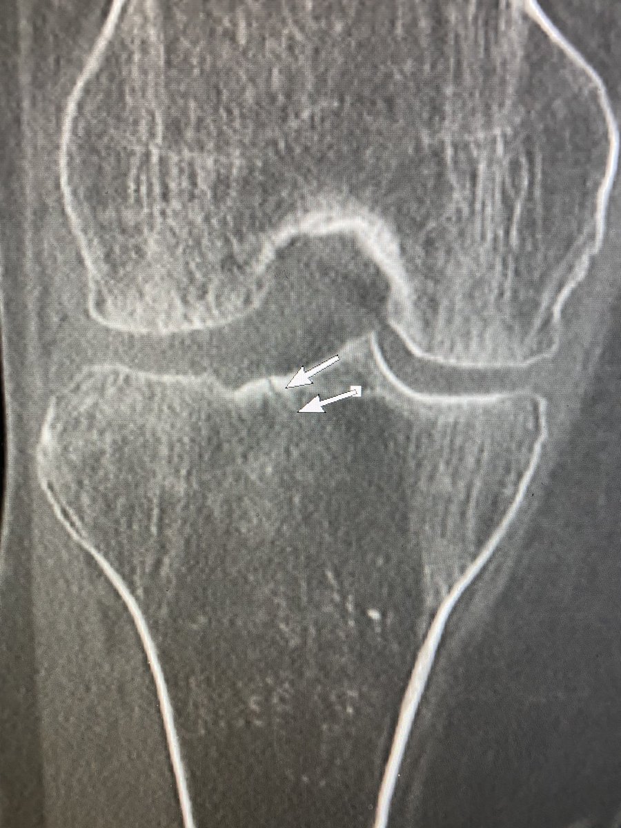 American Society of Emergency Radiology | ASER tweet media