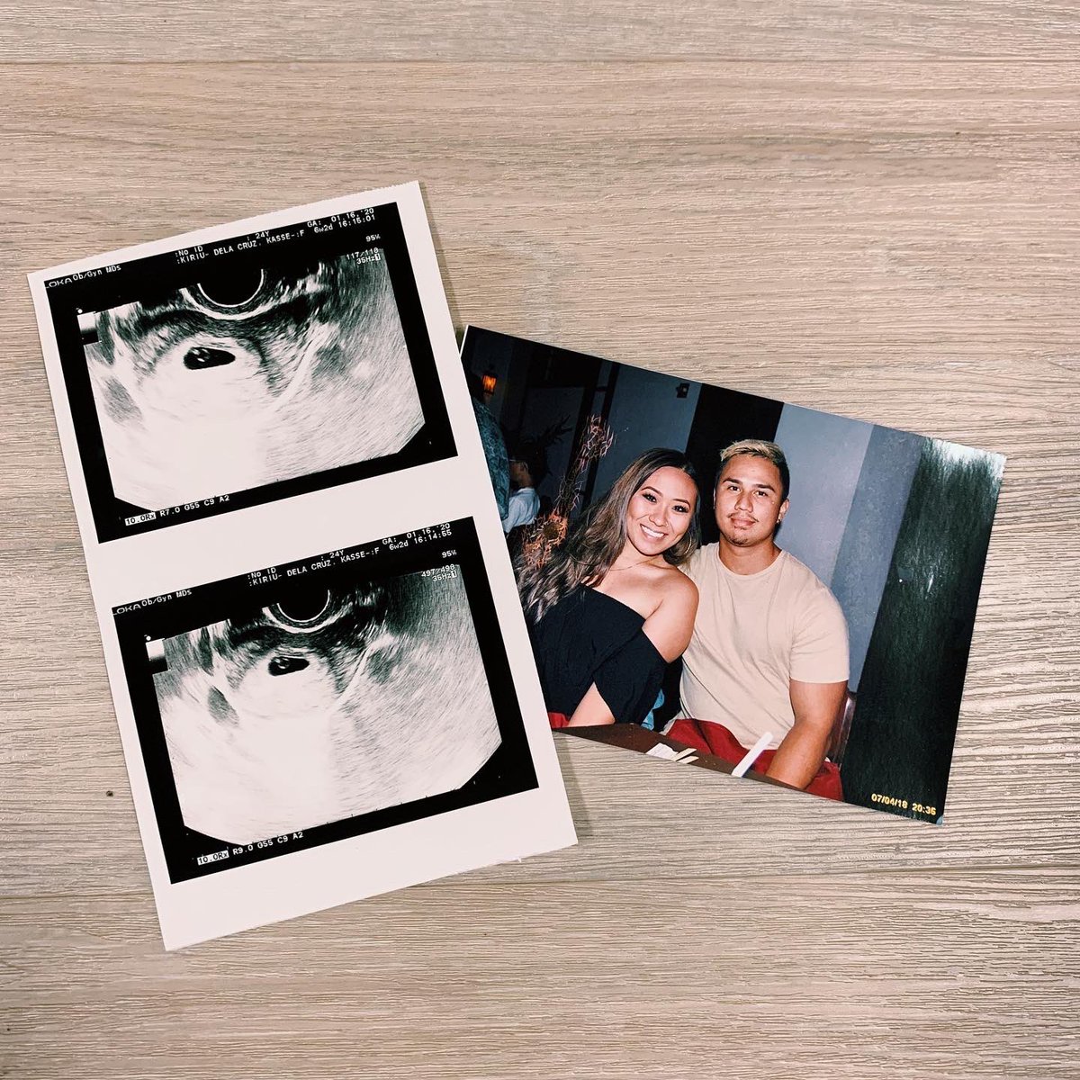 _kasselove's tweet photo. 2nd trimester here we comeeeee🤍✨ https://t.co/JWfNZofuCl