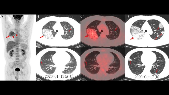 Resmi Twitter'da görüntüle