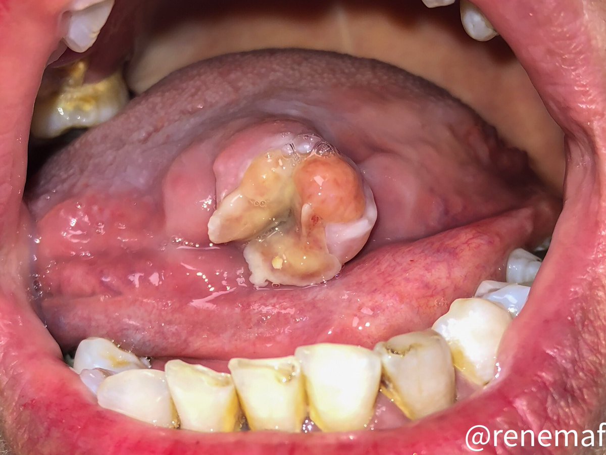 René Martínez Flores tweet media