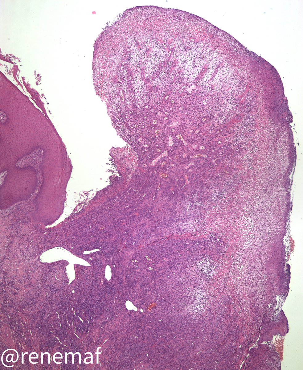 René Martínez Flores tweet media