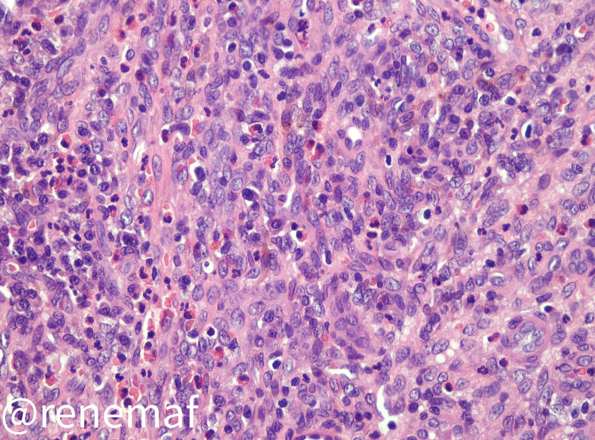 René Martínez Flores tweet media