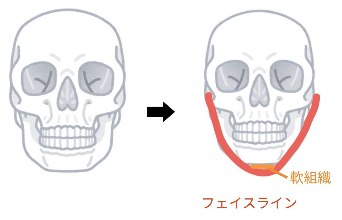 panitanpanitan's tweet photo. 今日口腔外科の検診だったので自分の画像を見てきたんですが意外な発見。私のイメージだと1枚目のようにオトガイが丸ければフェイスラインも丸いと思っていたのですが、実際は2枚目のようにオトガイは丸いけどフェイスラインは少し尖ってる。顎先にある軟組織の影響でオトガイは丸くても顎は少し尖る https://t.co/QNR6o4mKGM