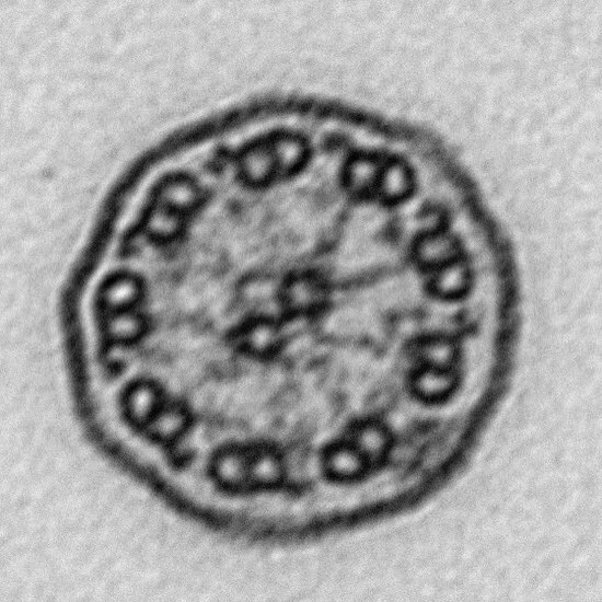 Cellfie3's tweet photo. Details of cilium radial spoke - #cellsareperfect 😍 #becauseweekend #weekend #electronmicroscopy #pcd #beatpcd #diagnosis #raredisease #research #WomenInSTEM #morningsbelike #blackandwhite #spoke https://t.co/sw66ZQ0FZX