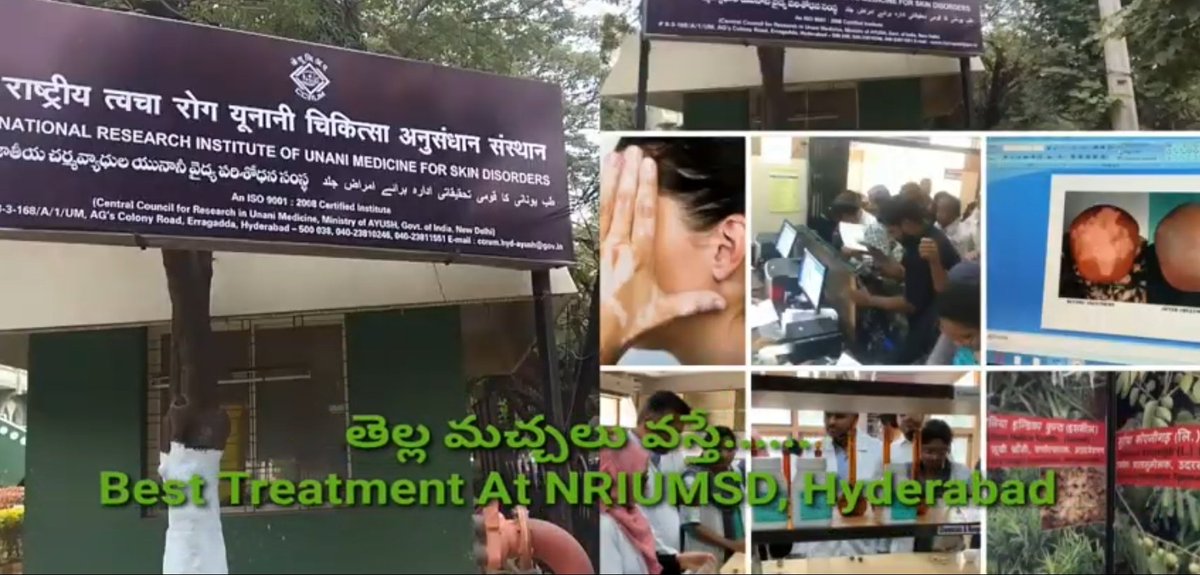ThiwariSury's tweet image. Watch this story for best vitiligo treatment center &amp;amp; subscribe our channel youtu.be/uVMo1Zf0Z_4
#vitiligo #TeluguNews #LeucodermaTreatment #SKINCARE #skincaretips #skincareroutine