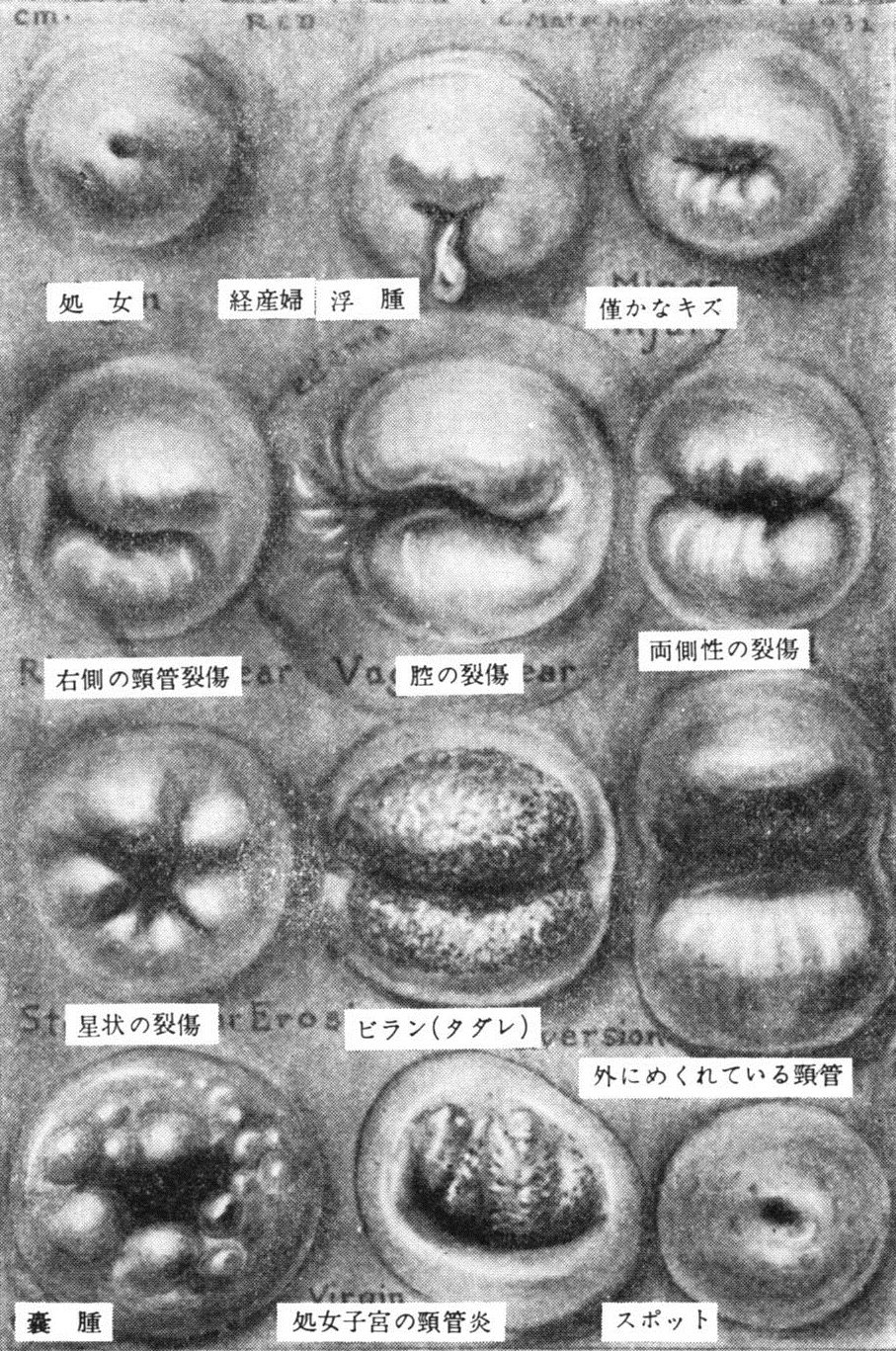 亜留間次郎 膣口が星状の裂傷っぽくって明らかに経産婦か中絶経験者っぽくてビッチすぎるので子宮口が処女のバージョンも欲しいですね
