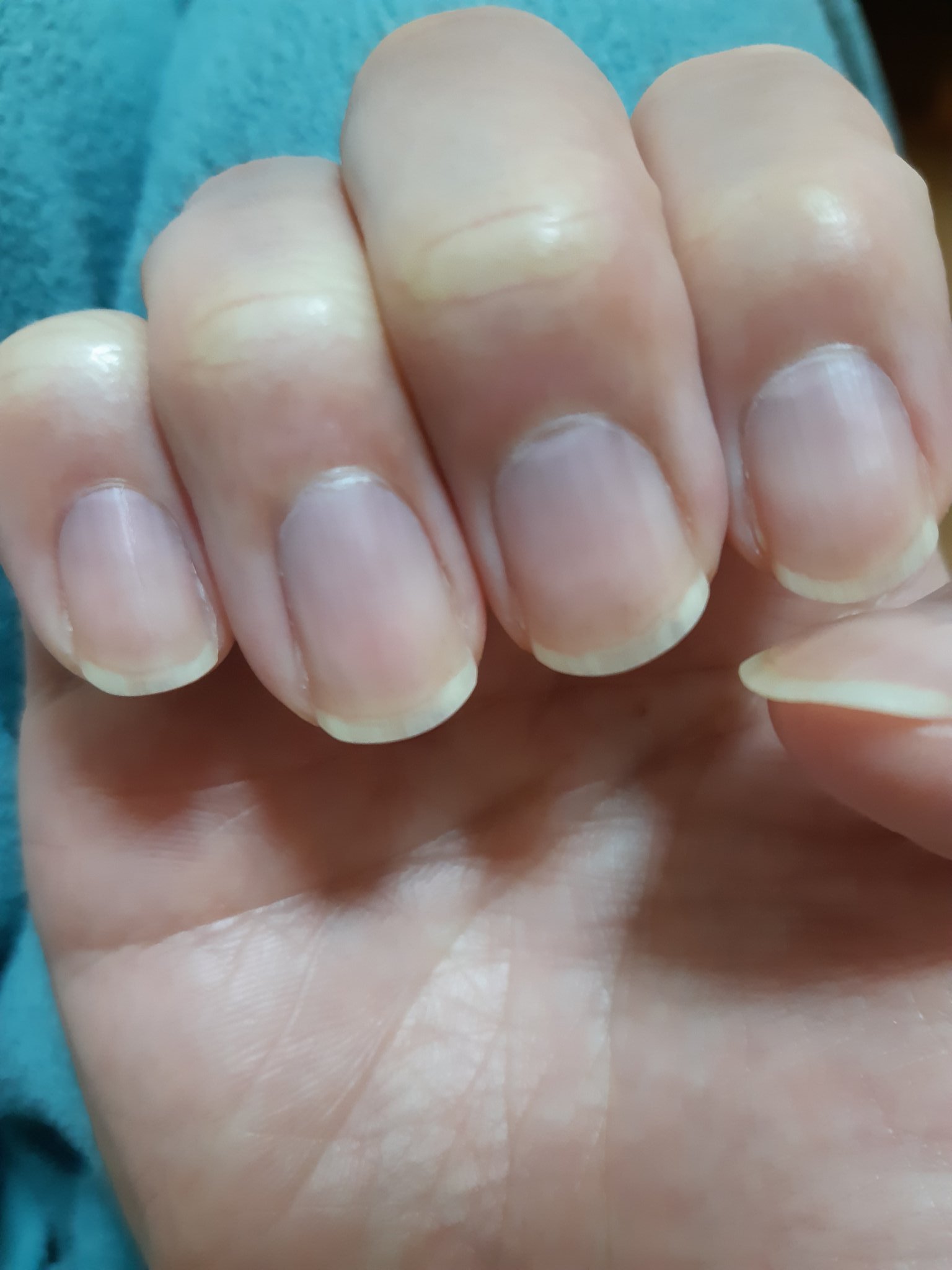 Nobu ネイルエンビー オフしました オイル塗る前に撮ったから 乾燥中 ファイリングと保湿します T Co R4urjrdfgz Twitter