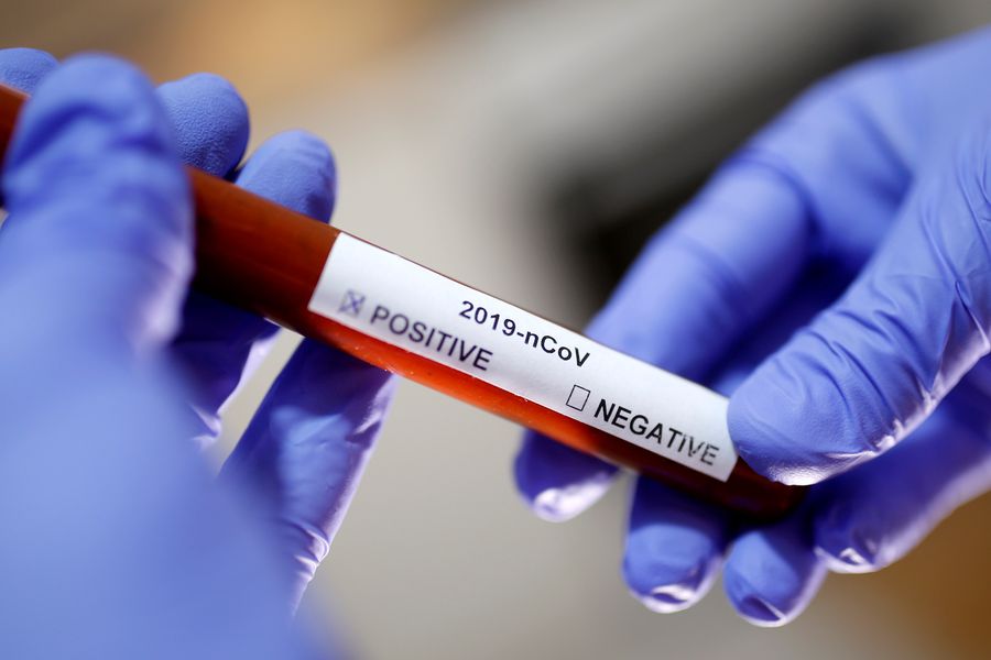 Coronavirus: ¿Por qué no se divulgan los nombres de los pacientes? Desde el primer caso, ya se han notificado cinco pacientes con coronavirus en el país, sin que se sepa la identidad de ninguno de ellos bit.ly/3cDzNSi