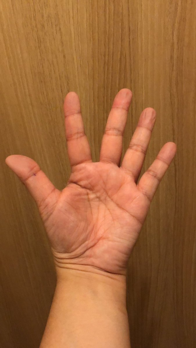 じん みのる 癒しを 私の手触りって ゴツゴツしてるらしい たしかに母ちゃんの手はすべすべでふっくらしてた 昔鑑定してもらった時は 職人の手 大器晩成 とか言われたけど現状 安月給ですねん 涙