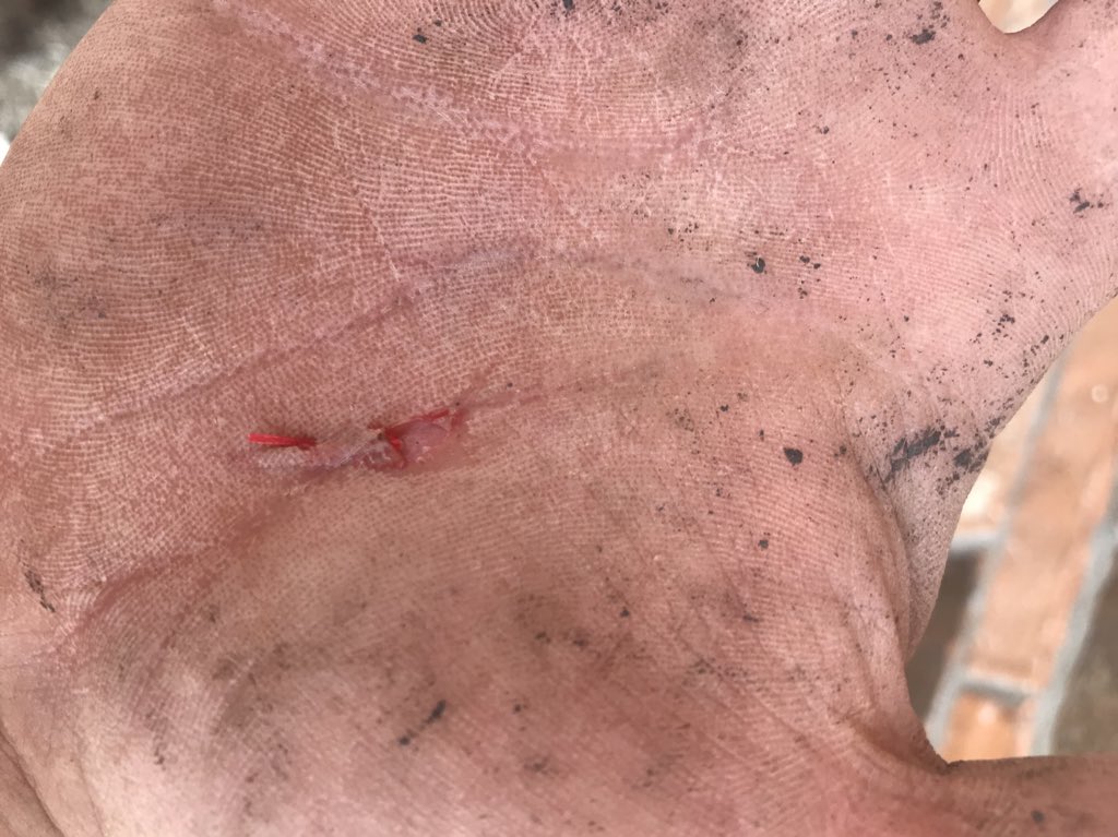 len0killer's tweet photo. Looks good to me #ThomasMedical https://t.co/ceB3ChlQbm