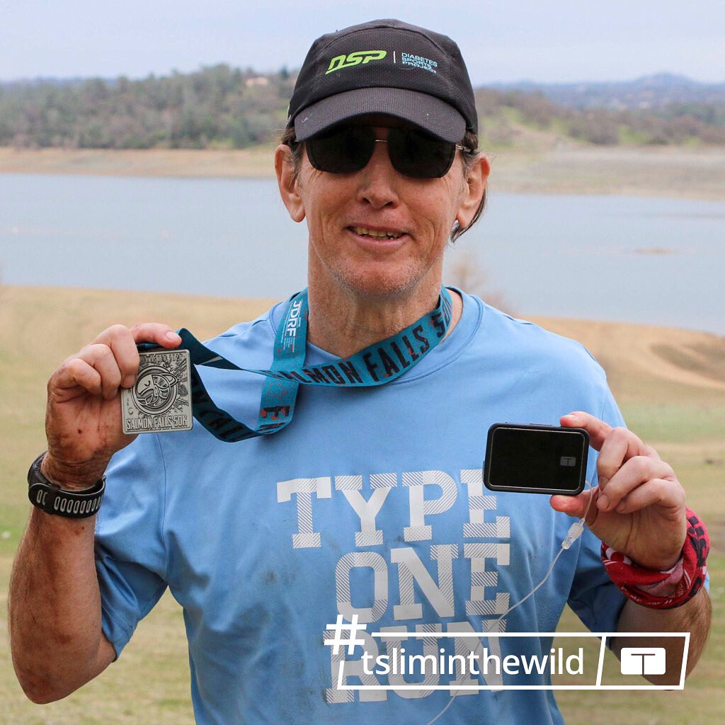 TandemDiabetes's tweet image. Jerry Nairn has had diabetes for 45 years! Last Saturday he completed his 100th race of 26 miles or longer at the @salmonfalls50k (benefiting @JDRF!) Congratulations, Jerry! Thank you for showing us what’s possible with type 1 diabetes. 🏃‍♂️ 💪 #tsliminthewild #tslimX2 #ControlIQ