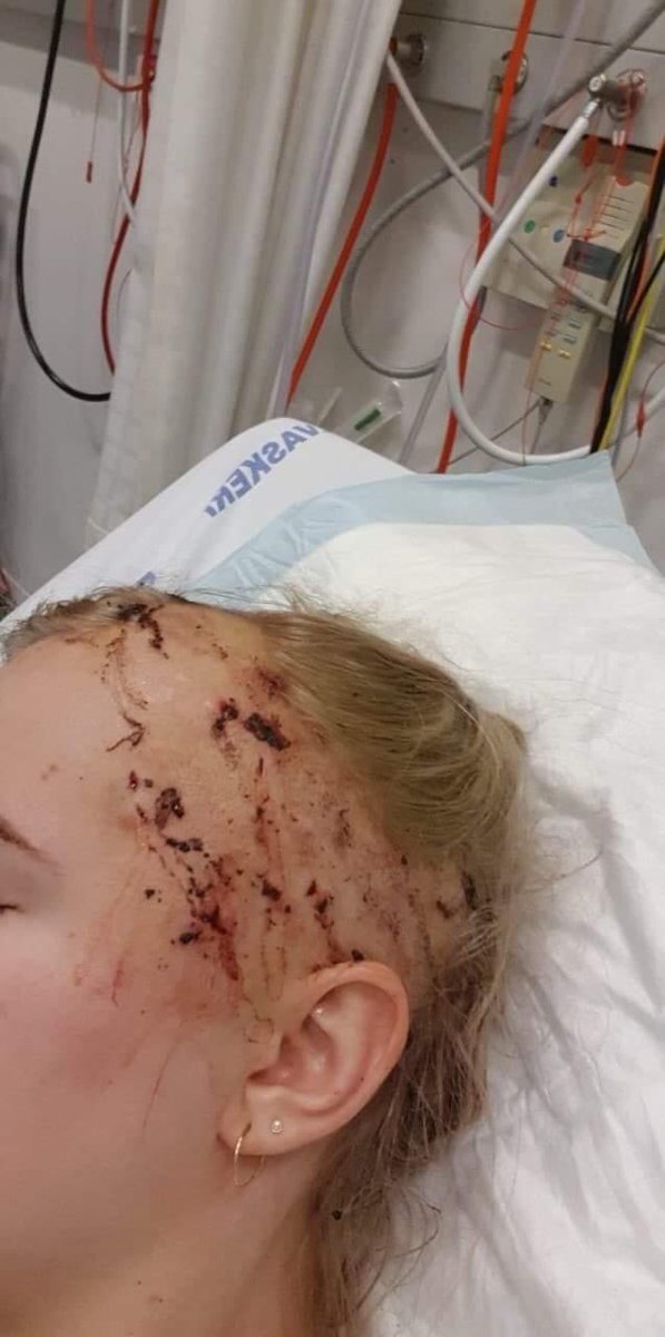 globalepilepsy's tweet photo. “Hi, my name is Line Kinnerup. I have had epilepsy all my life. I have tried a million different medicines and nothing works. So now the doctors want to see if they can give me the big surgery...” https://t.co/Wa7LXk2bZa