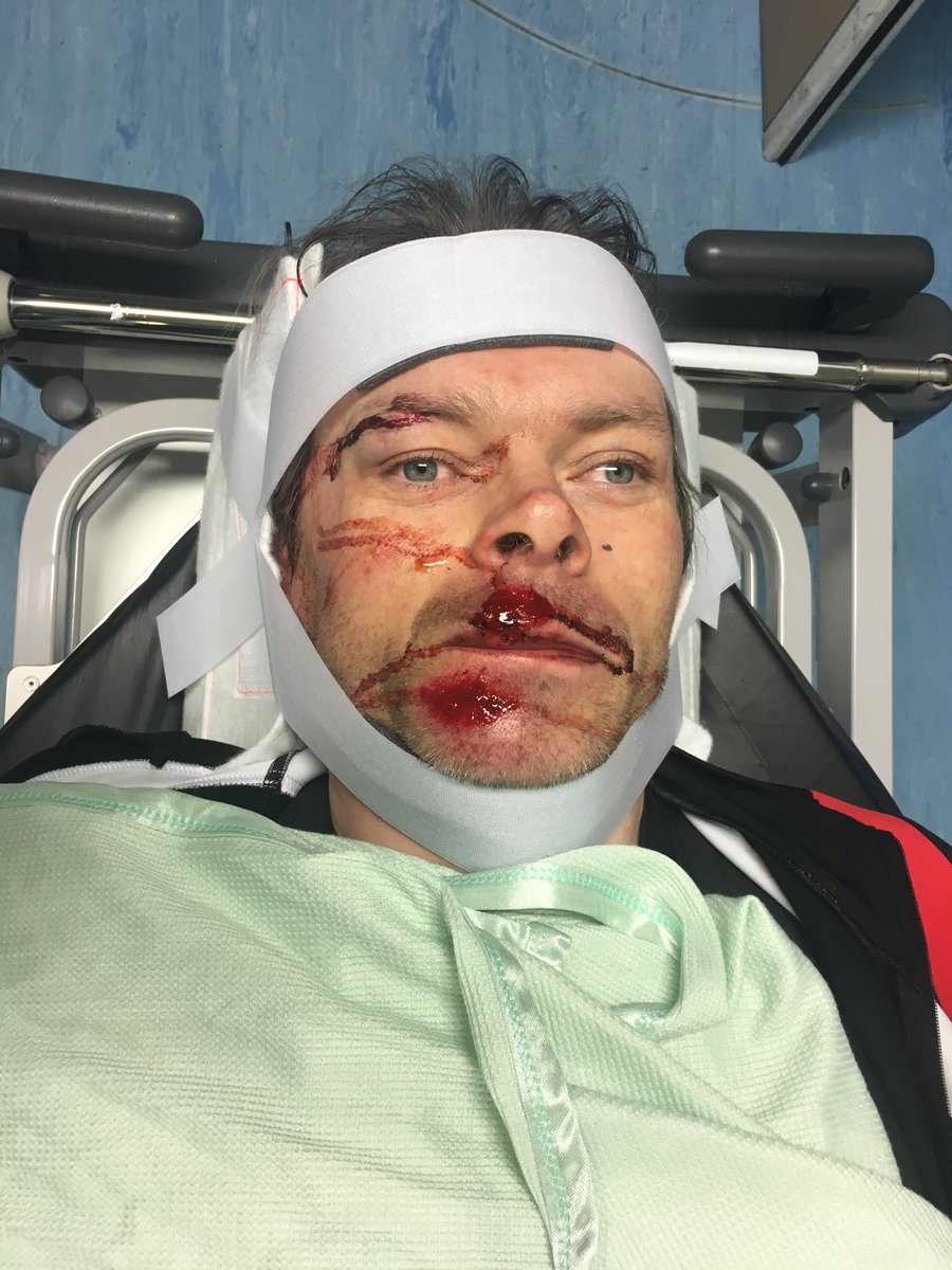 Michael Hutchinson tweet media