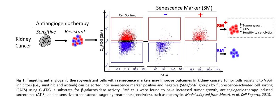 DrChoueiri's tweet photo. THANK YOU @CDMRP for highlighting #KidneyCancer research @DanaFarber with @XShirleyLiu &amp; @RoswellPark with @EbosLab looking at 2 approaches aimed at harnessing predictive markers of response to antiangiogenics in metastatic RCC https://t.co/qF98GeYEZm https://t.co/B2B3jY2LKv