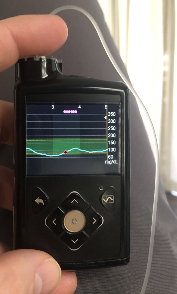 milsomben's tweet image. I can’t wait until the day when everyone’s blood sugar always looks like this @JDRF @JDRFResearch @JDRFTampaBay @JDRFceo #TypeOneNation #type1diabetes #typenone