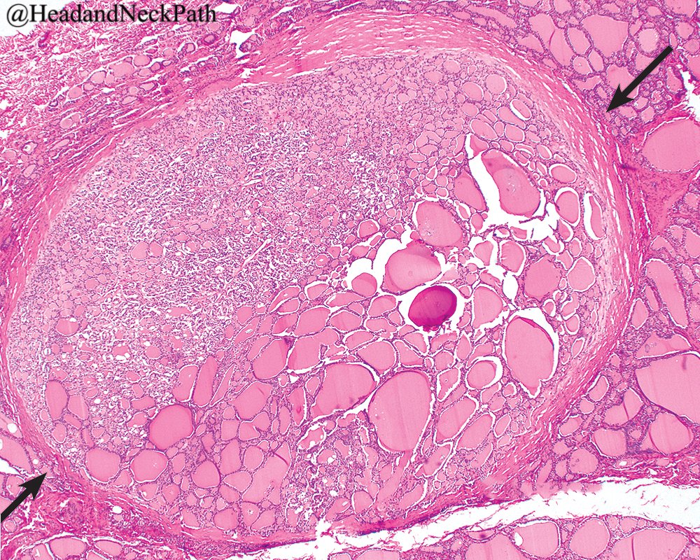 EndoPath tweet picture