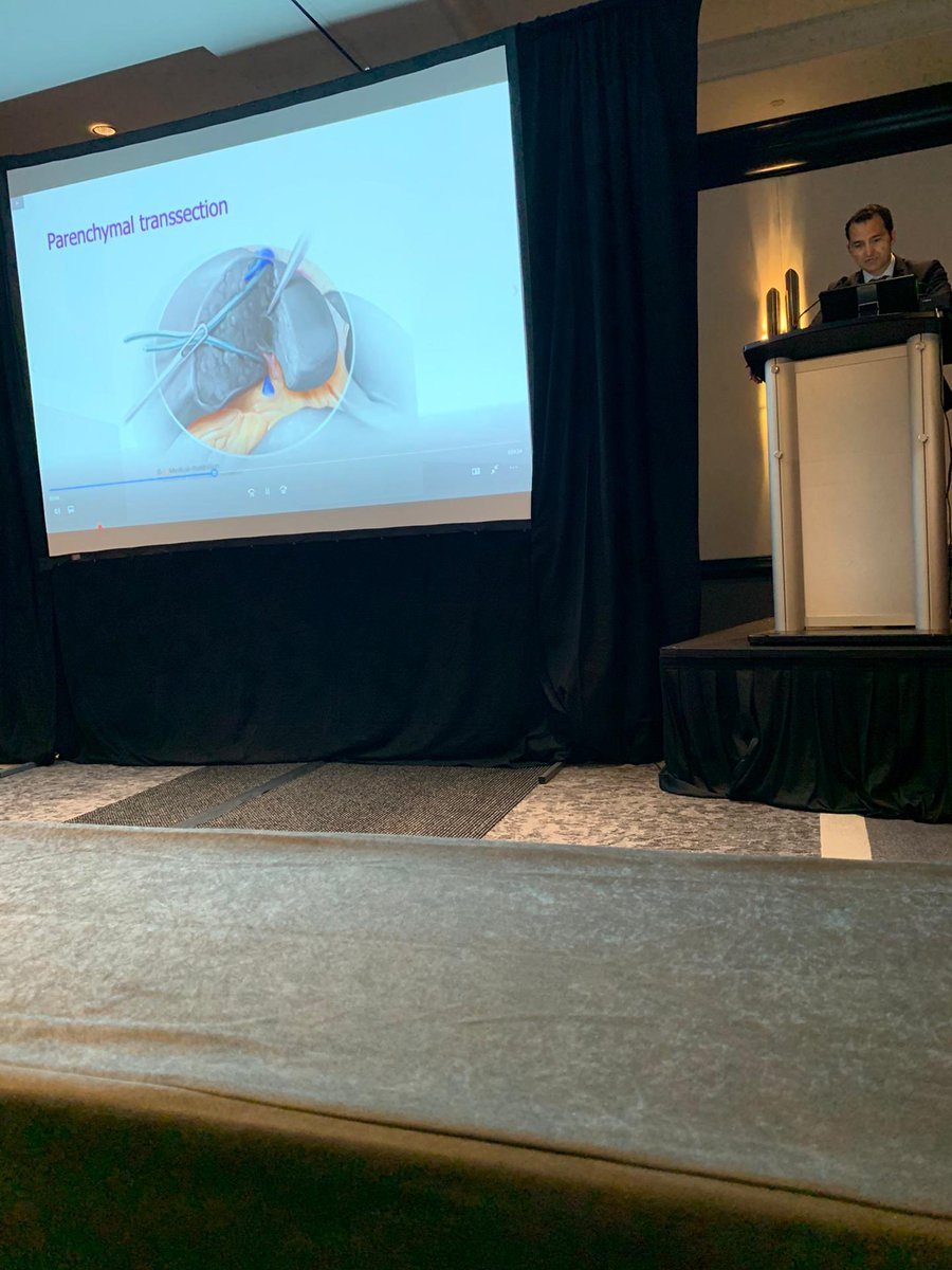 HondtMathieu's tweet photo. Grateful to present our video on laparoscopic ALPPS procedure to treat extensive colorectal liver metastases at the annual AHPBA meeting in Miami. Three years later NED. #AHPBA20 @azgroeninge @LoicBaekelandt @KOTKanker https://t.co/3Ys9LNDrdD